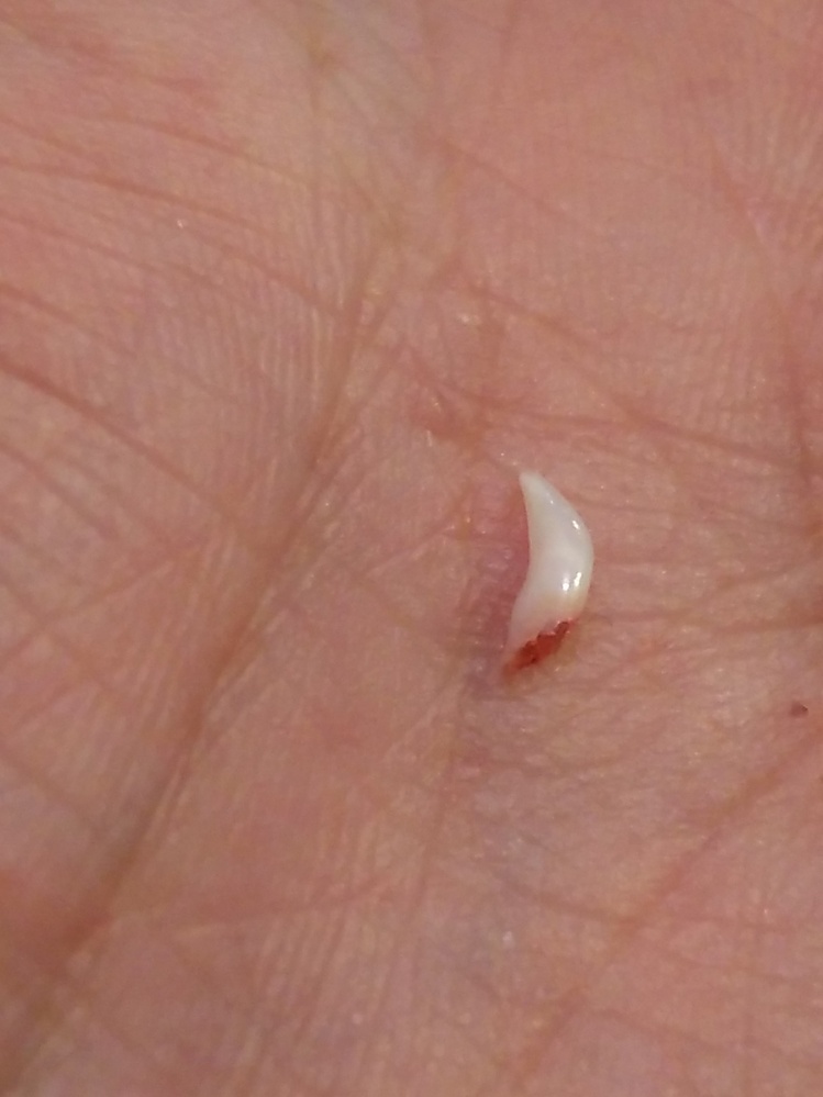 猫も歯の生え替わりしますか？半年の子猫ですが床に箱が落ちてました 