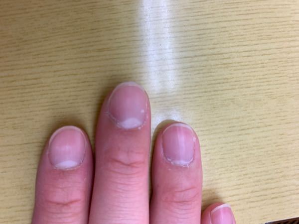 女子高生です 私は女なのに爪がすごく丸っこくて汚いです 今は爪しか載せ Yahoo 知恵袋