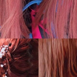 春から看護専門学校に通う者です 実習はもちろん暗くしますが Yahoo 知恵袋