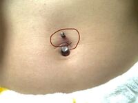 へそピをあけて1ヶ月たった今いきなり激痛になりました。座ったり立っ... - Yahoo!知恵袋