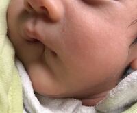 新生児下唇の口角が下がります 右側 寝てる時に分かりますが 自 Yahoo 知恵袋