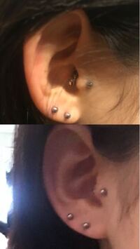 トラガスの穴を皮膚科であけることを考えています その病院のhpで耳珠軟骨と耳 Yahoo 知恵袋