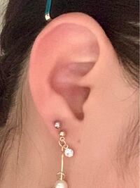 ピアスを開けて ５日目です 何か お風呂上がってから耳たぶの Yahoo 知恵袋