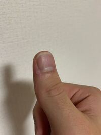 手の親指の爪の付け根辺りに魚の目のようなものができたのですがどうやったら消え Yahoo 知恵袋