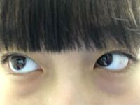 目の下にクマがある人をみたら どう思いますか 不細工 疲れてる 病気 Yahoo 知恵袋
