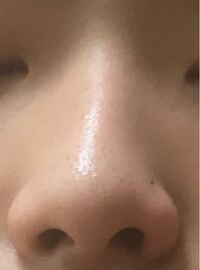 鼻の穴が左右非対称なのですが どちらが正しい形なのでしょうか また I Yahoo 知恵袋