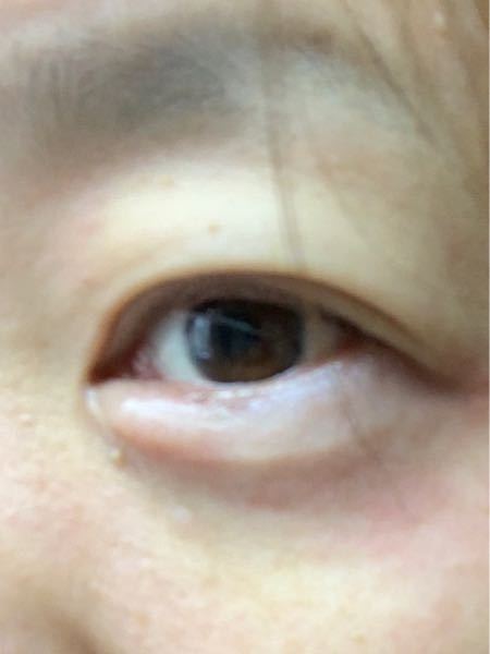 お見苦しい写真ですみません 泣き腫らした上にすっぴんなのでボ Yahoo 知恵袋