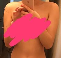 肩幅を狭くする手術ってあるんですか 私はとても肩幅が広いです 身長15 Yahoo 知恵袋