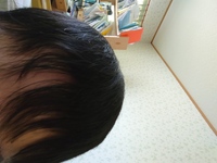 美容師の方お願いします 僕は高校生でハゲています そのため前髪がスカス Yahoo Beauty