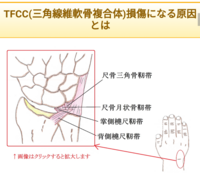 音ゲーをしていると手首の外側がとても痛いです その部位について調べてい Yahoo 知恵袋