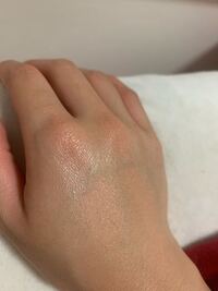肌のキメ というんでしょうか ふと手を見るとこんなに皮膚の凹凸って目立 Yahoo 知恵袋