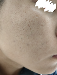 ツルハドラッグの仲良くなった美容のスタッフからカネボウのリサージ Yahoo 知恵袋