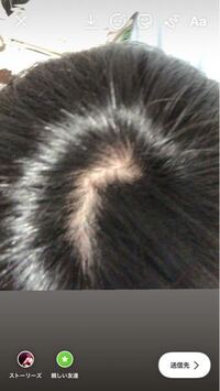 高校生です つむじ薄いですか 改善の余地はありますか Yahoo 知恵袋