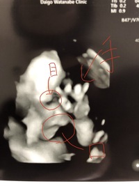 妊娠28週 第一子妊娠中です 今日4dエコーをしたのですが 上唇が Yahoo 知恵袋