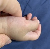 今 一歳4ヶ月の子供なんですが 写真わ見づらいのですが 手首だけに楕円形みた Yahoo 知恵袋