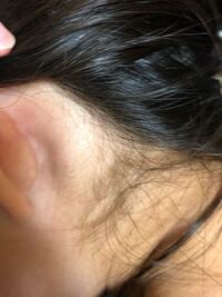 急ぎお願いします 子供が昨日ベットの角にぶつけたみたいで 耳の後ろ Yahoo 知恵袋