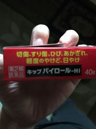 1歳の娘がマッチで火傷をしてしまいました 赤みがあります 父がキップパ Yahoo 知恵袋