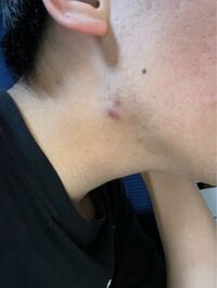 お口の中の できもの 調布市の歯科 歯医者ならあきら歯科 柴崎駅改札正面