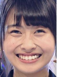 Hkt48の松岡はなってそんなに可愛いですか 自分は外斜視なのが気にな Yahoo 知恵袋