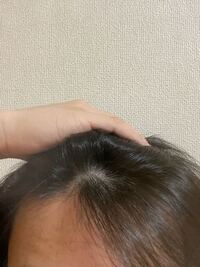 前髪の痛み 頭皮ではない が激しく 少し抜け毛が心配です 髪の Yahoo 知恵袋
