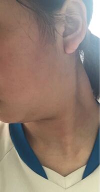 これはストレートネックだから二重アゴになってしまっているのでしょうか ストレ Yahoo 知恵袋