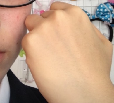 ベストコレクション】 顔 黄疸 画像 733741-顔 黄疸 画像 - muryoview