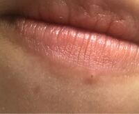 3ヶ月前くらい から唇にこんな出来物 かわからない硬い粒があるんで Yahoo 知恵袋