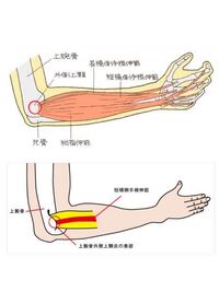 肘についての質問です 肘を曲げると外側部分に出っ張りみたいな Yahoo 知恵袋