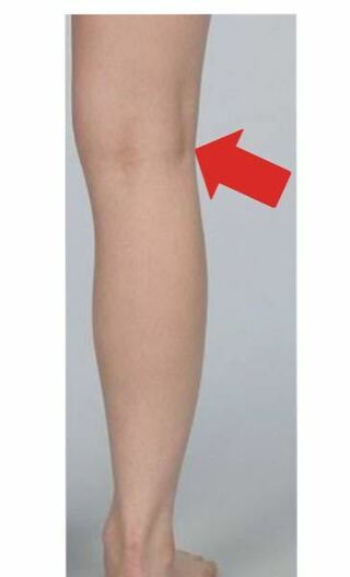 この膝窩部に出る筋腹は何筋のものですか？ - 腓腹筋だと起始は大腿... - Yahoo!知恵袋