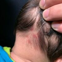 生後1ヶ月半の息子がいます いつから出来ていたのか分かりませ Yahoo 知恵袋