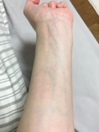 今日血管が普通の人よりよく見えるね と言われたのですがこれはよく見える方な Yahoo 知恵袋