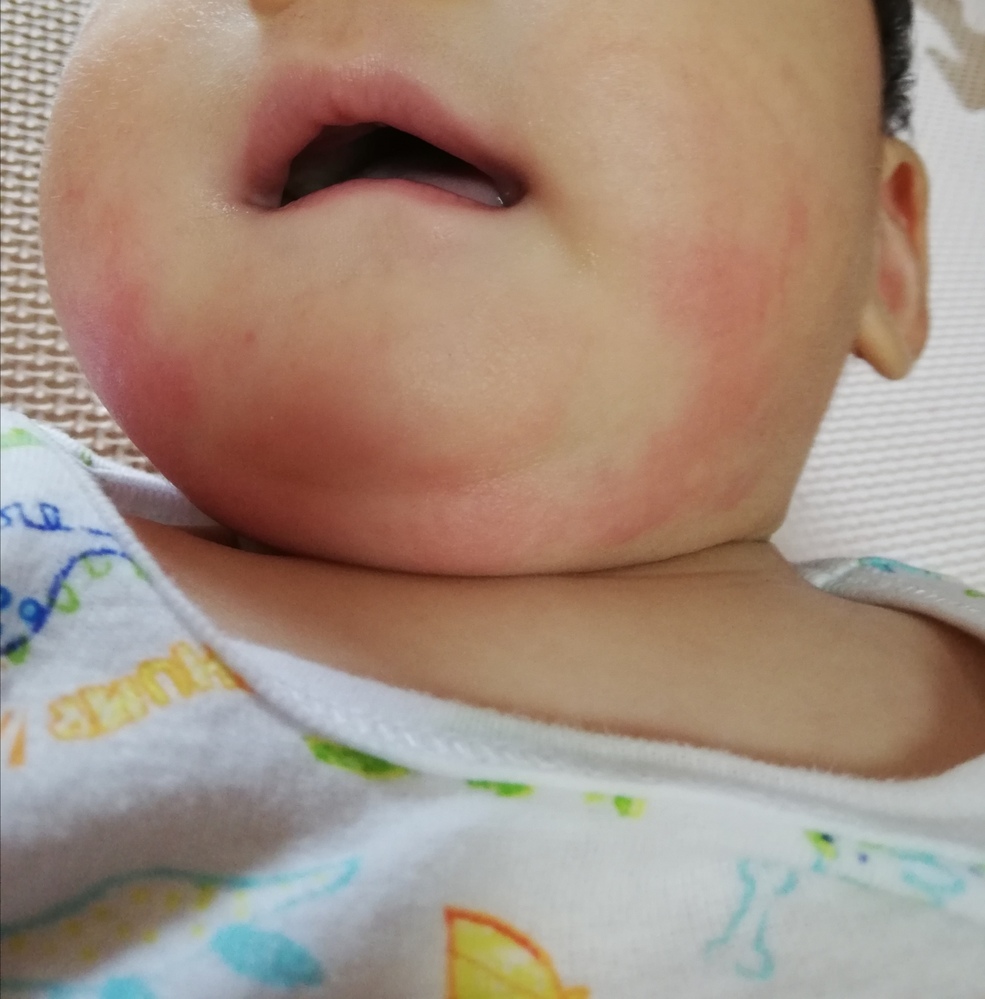 赤ちゃん 唇 切っ た 赤ちゃんの口から血が 口の中が切れたときはどうすればいいの
