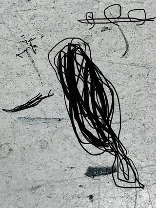 僕は飛蚊症が酷いです これ大丈夫なんでしょうか Yahoo 知恵袋