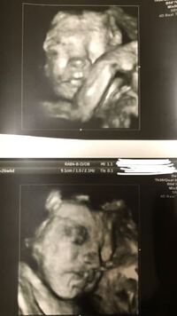 今 26w6dの7ヶ月の妊婦です 4dエコーで初めて赤ちゃんの顔が見え Yahoo 知恵袋