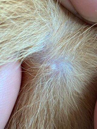 後頭部 でき もの 後頭部にしこりができる原因は 押すと痛いのは病気なの