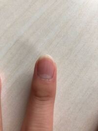 この線なんですか 消えません この前爪を磨きました 極度の縦じわ持ちで Yahoo 知恵袋