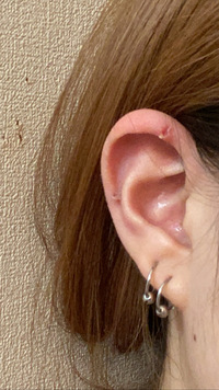 インダストリアルの位置ダサいですか 一ヶ月前に開けたのですが Yahoo 知恵袋
