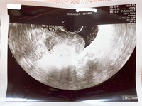 本日妊娠5週0日です 妊娠検査薬で濃い陽性あり昨日病院受診しました まだ胎嚢 Yahoo 知恵袋