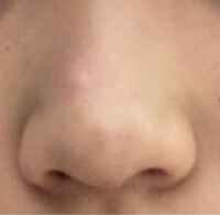 よく肌が綺麗と言われますが 最近コロナでマスクを常に着用しているせ Yahoo 知恵袋