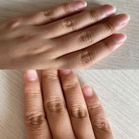 指先の縦じわについて最近 両手の指先に縦じわが出るようになり な Yahoo 知恵袋