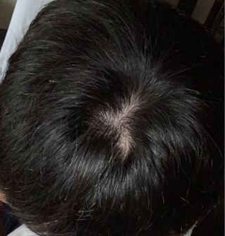これつむじハゲてません 部屋の電気を消してフラッシュありで撮りました Yahoo 知恵袋