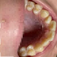 これって歯並び悪すぎですよね 蛇足ですが横から見るとかなりの出っ歯です Yahoo 知恵袋