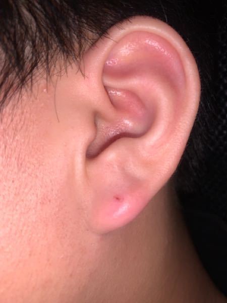 一昨日、ピアスを開けました。 - ファーストピアスをしていたの