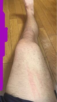 助けてください 太腿を細くしたいですサッカーをやっていました外側は筋肉で Yahoo 知恵袋