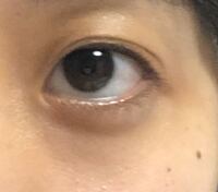 目の周り黒いですかね 友達によく アイシャドウしてる や 目 Yahoo 知恵袋