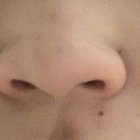 この鼻の左下の位置のホクロってどう思いますか 結構気にしますか 鼻 Yahoo 知恵袋