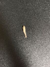 根管治療中の歯の中からこんな詰め物が取れてしまいました 至急病院 Yahoo 知恵袋