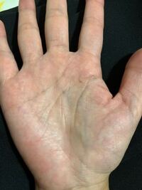 10年前 40過ぎに大病 天涯孤独と言われた手相占いですが また気になってき Yahoo 知恵袋