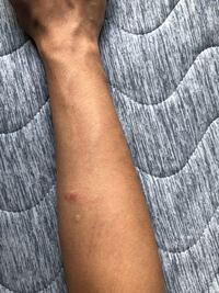 21歳の男です 腕毛が平均と比べると濃い方ですか 薄いほうですか Yahoo 知恵袋