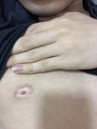 閲覧注意真剣な悩みなのですが乳首の色が真ん中だけ白いです これは病 Yahoo 知恵袋